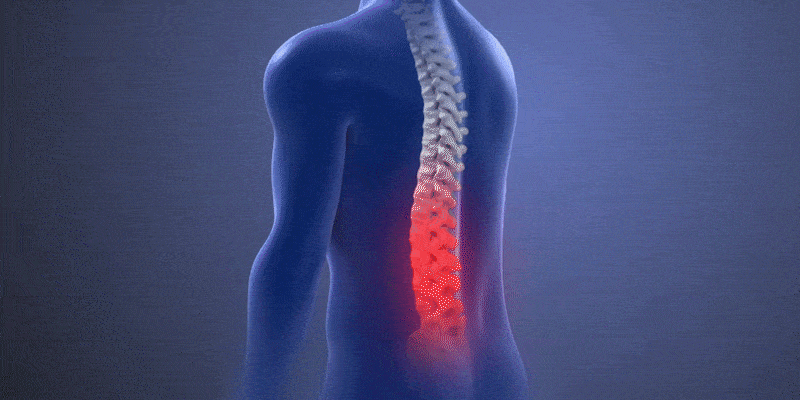 Pain-Animation